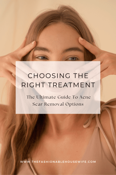 Choosing The Right Treatment: The Ultimate Guide To Acne Scar Removal Options