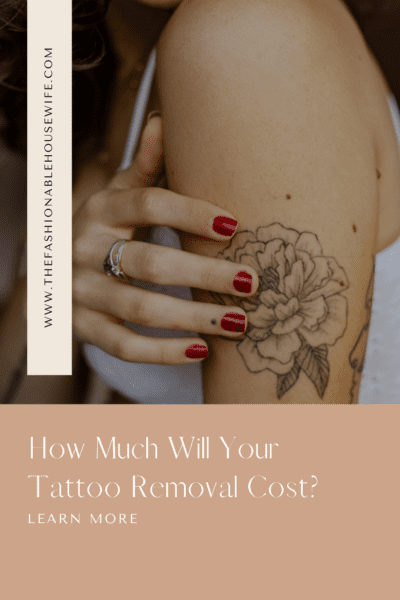 How Much Will Your Tattoo Removal Cost?