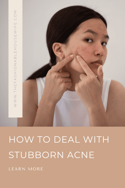 How To Deal With Stubborn Acne