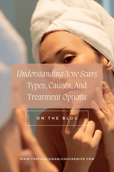 Understanding Acne Scars: Types, Causes, And Treatment Options